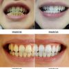 Teeth Whitener-10ml Teeth Whitening Water Oral Hygiene Cleaning Teeth Care Tooth Cleaning Whitening Water Clareamen