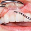 Teeth Whitener-10ml Teeth Whitening Water Oral Hygiene Cleaning Teeth Care Tooth Cleaning Whitening Water Clareamen